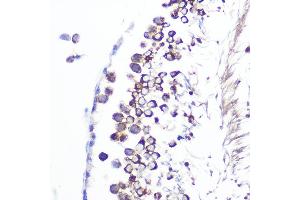 Immunohistochemistry of paraffin-embedded rat testis using J/CSN5/COPS5 Rabbit mAb (ABIN7266497) at dilution of 1:100 (40x lens). (COPS5 anticorps)