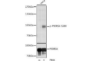 Western blot analysis of extracts of various cell lines, using Phospho-p90Rsk/RSK1/RPS6K-S380 antibody (ABIN6135275, ABIN6136172, ABIN6136173 and ABIN6225586) at 1:1000 dilution or RPS6K antibody (5718). (RPS6KA1 anticorps  (pSer380))