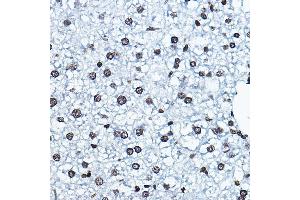 Immunohistochemistry of paraffin-embedded mouse liver using K Rabbit pAb (ABIN6128005, ABIN6142689, ABIN6142690 and ABIN6221516) at dilution of 1:100 (40x lens).