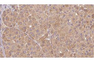 anti-Urotensin 2 (UTS2) (C-Term) antibody