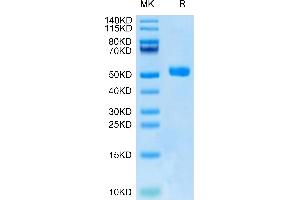 Human DKK1 N terminal Domain on Tris-Bis PAGE under reduced condition.