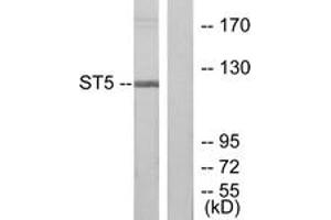 Western blot analysis of extracts from COLO205 cells, using ST5 Antibody. (ST5 anticorps  (AA 411-460))