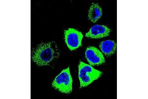 Confocal immunofluorescent analysis of Y Antibody (C-term) (ABIN655601 and ABIN2845085) with NCI- cell followed by Alexa Fluor 488-conjugated goat anti-rabbit lgG (green). (YI016 (AA 253-280), (C-Term) anticorps)