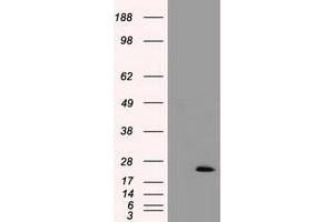 HEK293T cells were transfected with the pCMV6-ENTRY control (Left lane) or pCMV6-ENTRY TNNI3 (Right lane) cDNA for 48 hrs and lysed. (TNNI3 anticorps)