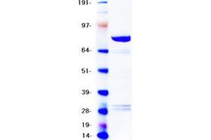 Validation with Western Blot