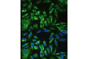 Immunofluorescence analysis of U-2 OS cells using OGN antibody (ABIN6131952, ABIN6145008, ABIN6145009 and ABIN6222384) at dilution of 1:100. (OGN anticorps  (AA 20-298))