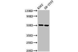 Western Blot Positive WB detected in: K562 whole cell lysate, SH-SY5Y whole cell lysate All lanes: GPA33 antibody at 3. (GPA33 anticorps  (AA 22-235))