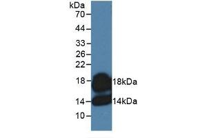Rabbit Capture antibody from the kit in WB with Positive Control: 293F transfected with MCP3 gene.
