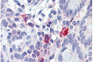 Small intestine, Human: Formalin-Fixed, Paraffin-Embedded (FFPE) (TNFAIP3 anticorps)