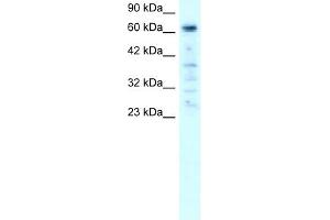 PARP3 antibody used at 1-2 ug/ml to detect target protein. (PARP3 anticorps)