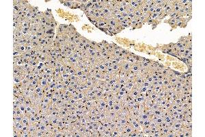 anti-Thrombospondin 4 (THBS4) antibody