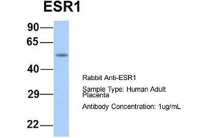 Host:  Rabbit  Target Name:  ESR1  Sample Type:  Human Adult Placenta  Antibody Dilution:  1.