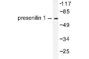 Image no. 1 for anti-Presenilin 1 (PSEN1) antibody (ABIN271789) (Presenilin 1 anticorps)