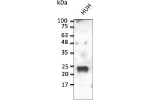 Western Blotting (WB) image for anti-RAB1A, Member RAS Oncogene Family (RAB1A) (C-Term) antibody (ABIN7272978) (RAB1A anticorps  (C-Term))