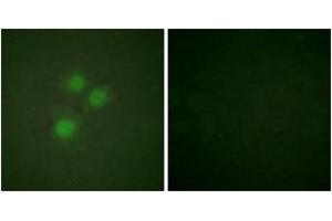 Immunofluorescence (IF) image for anti-MKI67 FHA Domain-Interacting Nucleolar Phosphoprotein (MKI67IP) (AA 200-249) antibody (ABIN2888898) (NIFK anticorps  (AA 200-249))