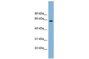 SLFN12 antibody used at 1 ug/ml to detect target protein. (SLFN12 anticorps  (Middle Region))