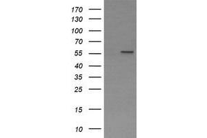 anti-Phosphoribosyl Pyrophosphate Amidotransferase (PPAT) (AA 42-278) antibody