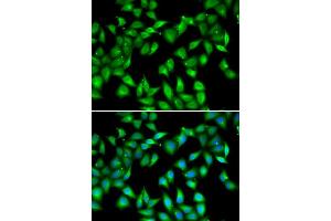 Immunofluorescence analysis of U2OS cells using MYL3 antibody (ABIN6133198, ABIN6144249, ABIN6144250 and ABIN6222363). (MYL3/CMLC1 anticorps  (AA 1-195))
