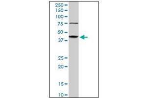 Western Blotting (WB) image for anti-Abhydrolase Domain Containing 5 (ABHD5) antibody (ABIN781986) (ABHD5 anticorps)