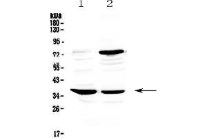 Western blot analysis of CD23 using anti-CD23 antibody .