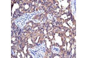 NME1 antibody was used for immunohistochemistry at a concentration of 4-8 ug/ml. (NME1 anticorps  (N-Term))