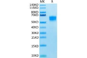 Human NKG2D on Tris-Bis PAGE under reduced condition. (KLRK1 Protein (AA 78-216) (Fc-DYKDDDDK Tag))