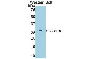 Western blot analysis of the recombinant protein. (IL22RA2 anticorps  (AA 30-228))