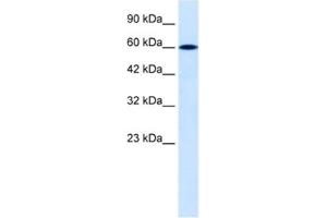 Western Blotting (WB) image for anti-Dachshund 2 (DACH2) antibody (ABIN2460463) (DACH2 anticorps)