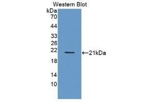 Detection of Recombinant PDGFBB, Human using Monoclonal Antibody to Platelet Derived Growth Factor BB (PDGF BB) (PDGF-BB Homodimer (AA 82-190) anticorps)
