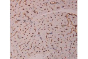IHC-P analysis of heart tissue, with DAB staining. (HIPK1 anticorps  (AA 1-290))