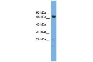 WB Suggested Anti-GCLC Antibody Titration: 0. (GCLC anticorps  (Middle Region))