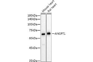 Western blot analysis of extracts of various cell lines, using  Rabbit pAb antibody (ABIN6127432, ABIN6136873, ABIN6136875 and ABIN6223859) at 1:500 dilution. (Angiopoietin 1 anticorps  (AA 260-400))