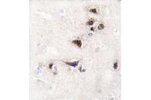 Formalin-fixed and paraffin-embedded human brain tissue reacted with CAMK2 alpha Antibody (C-term) , which was peroxidase-conjugated to the secondary antibody, followed by DAB staining.