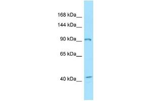 WB Suggested Anti-EPHB3 Antibody Titration: 1. (EPH Receptor B3 anticorps  (C-Term))