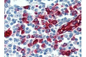 Immunohistochemistry (IHC) image for anti-Selectin P Ligand (SELPLG) antibody (ABIN614543) (SELPLG anticorps)