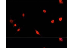 Immunofluorescence analysis of PC12 cells using PRDM14 Polyclonal Antibody at dilution of 1:100.