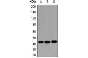 Western blot analysis of HSD17B2 expression in SW480 (A), mouse liver (B), mouse kidney (C) whole cell lysates. (HSD17B2 anticorps)