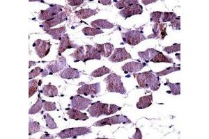 TrkA antibody immunohistochemistry analysis in formalin fixed and paraffin embedded human skeletal muscle. (TRKA anticorps  (AA 769-796))