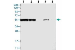 Western blot analysis of Lane 1: RT-4, Lane 2: U-251 MG, Lane 3: Human Plasma, Lane 4: Liver, Lane 5: Tonsil with FKBP9 polyclonal antibody  at 1:250-1:500 dilution. (FKBP9 anticorps)