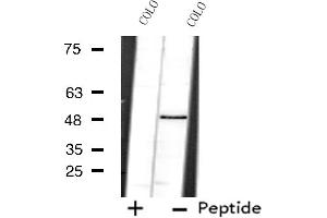 Western blot analysis of extracts from COLO cells using PRPF19 antibody. (PRP19 anticorps  (N-Term))