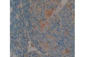 IHC-P analysis of Human Tissue, with DAB staining. (IL1F9 anticorps  (AA 1-158))