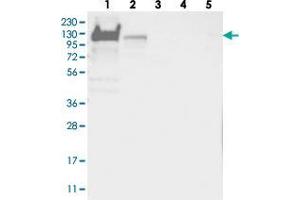 Western blot analysis of Lane 1: RT-4, Lane 2: U-251 MG, Lane 3: Human Plasma, Lane 4: Liver, Lane 5: Tonsil with YTHDC1 polyclonal antibody  at 1:250-1:500 dilution. (YTHDC1 anticorps)