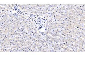 Detection of CRP in Bovine Liver Tissue using Polyclonal Antibody to C Reactive Protein (CRP)