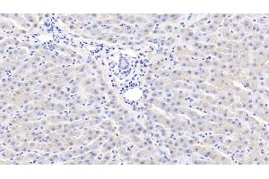 Detection of CRP in Bovine Liver Tissue using Polyclonal Antibody to C Reactive Protein (CRP) (CRP anticorps  (AA 14-224))