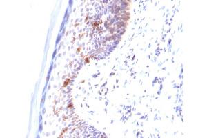 Formalin-fixed, paraffin-embedded human Skin stained with CD1a Mouse Monoclonal Antibody (C1A/711). (CD1a anticorps)