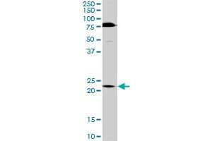 TRIM55 MaxPab rabbit polyclonal antibody. (TRIM55 anticorps  (AA 1-452))