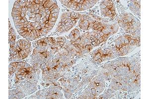 Immunohistochemistry (IHC) image for anti-Carcinoembryonic Antigen-Related Cell Adhesion Molecule 1 (CEACAM1) (AA 35-433) antibody (ABIN7455148) (Recombinant CEACAM1 anticorps  (AA 35-433))