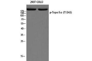 Western Blot (WB) analysis of 293T COLO205 using p-Topo IIalpha (T1343) antibody. (Topo IIalpha (pThr1343) anticorps)