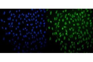 IF analysis of PRDM14 using anti-PRDM14 antibody (ABIN7603152).