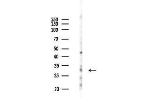 anti-PSME3 (PSME3) (N-Term) antibody
